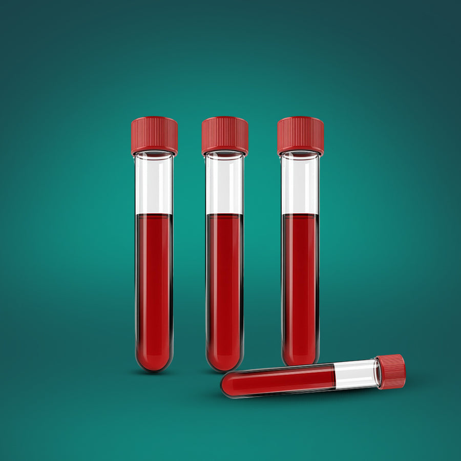 Labs